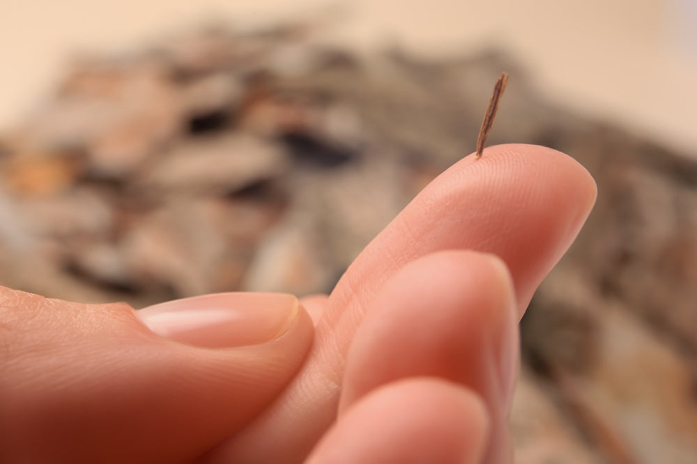 How to Remove Splinters | Ultimate Guide
